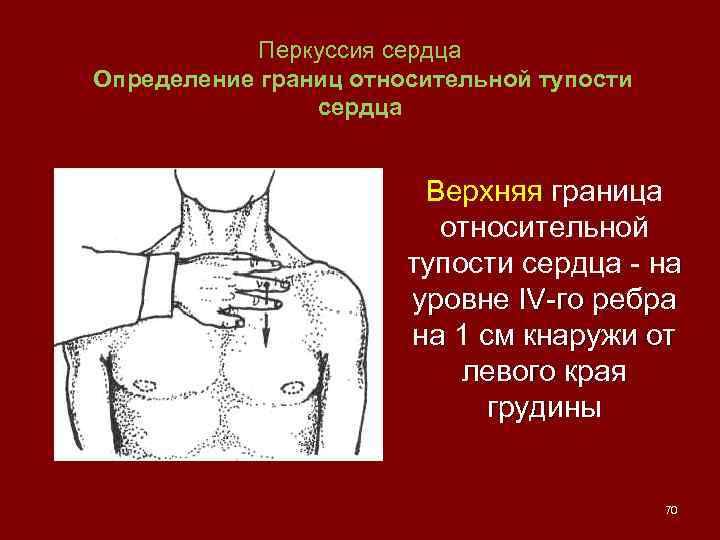 Перкуссия сердца. Относительная тупость сердца перкуссия норма. Правая граница относительной тупости сердца перкуссия. Топографическая перкуссия сердца границы. Границы относительной тупости сердца перкуссия.