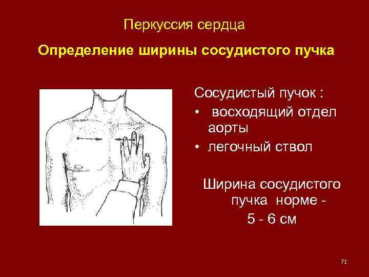 Перкуссия сердца Определение ширины сосудистого пучка Сосудистый пучок : • восходящий отдел аорты •