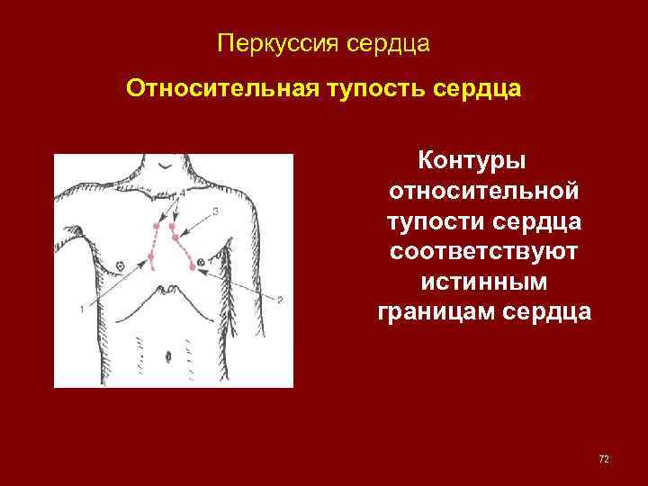 Перкуссия сердца Относительная тупость сердца Контуры относительной тупости сердца соответствуют истинным границам сердца 72