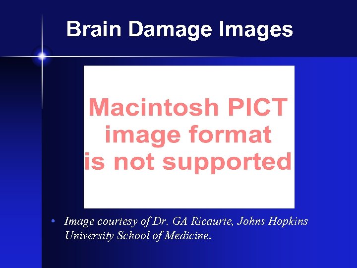 Brain Damage Images • Image courtesy of Dr. GA Ricaurte, Johns Hopkins University School