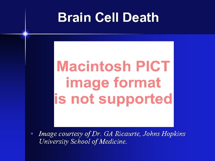 Brain Cell Death • Image courtesy of Dr. GA Ricaurte, Johns Hopkins University School