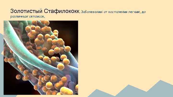 Золотистый Стафилококк. Заболевания: от воспаления легких, до различных сепсисов. 