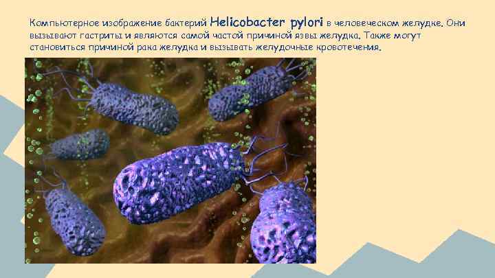 Компьютерное изображение бактерий Helicobacter pylori в человеческом желудке. Они вызывают гастриты и являются самой