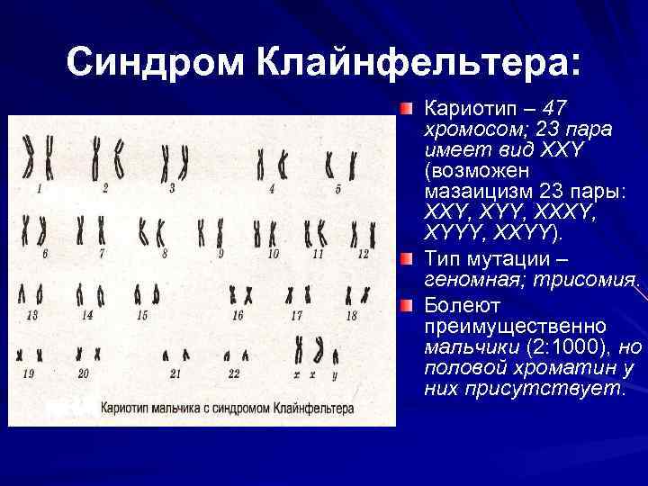 Хромосомы лучше видны. Кариотип синдром Клайнфельтера кариотип. Кариотип больного с синдромом Клайнфельтера. Кариограмма синдрома Эдвардса. Синдром Клайнфельтера хромосомный набор.