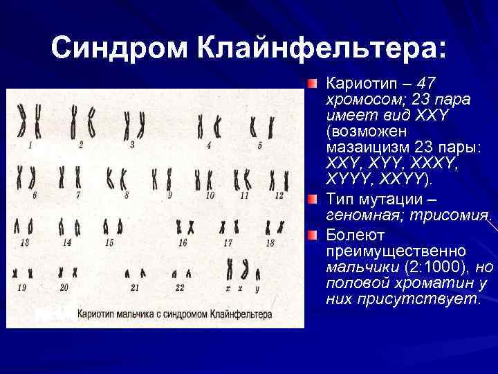 Хромосомы человека половая клетка. Кариотип больного с синдромом Клайнфельтера. Кариотип больных с синдромом Клайнфельтера. Кариотип синдром Клайнфельтера кариотип.