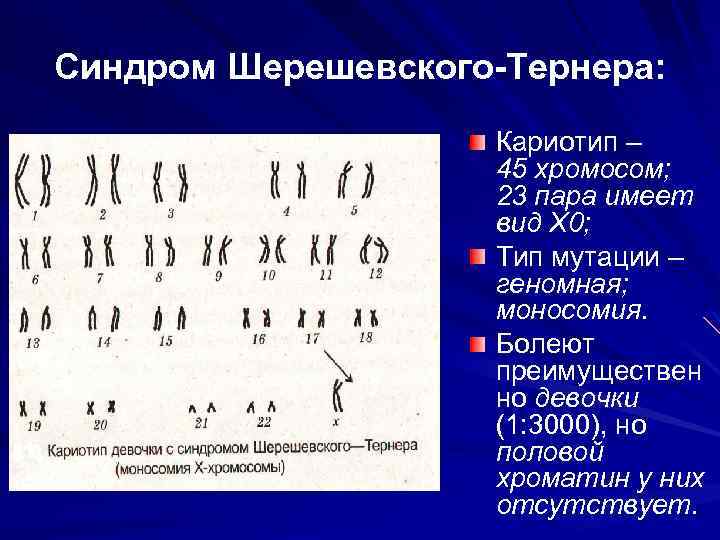 Назовите число хромосом. Синдром Шерешевского Тернера набор хромосом. Синдром Шерешевского Тернера кариотип. Синдром Тернера кариотип.