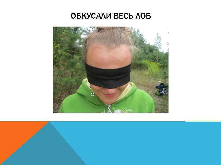 ОБКУСАЛИ ВЕСЬ ЛОБ 