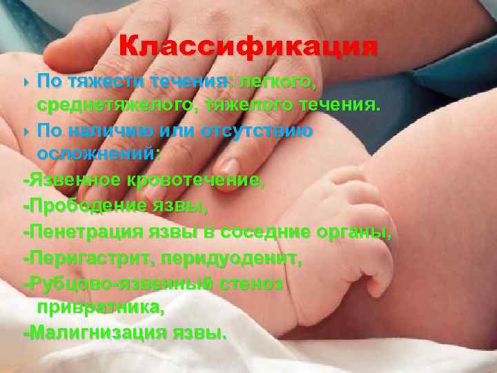 Классификация По тяжести течения: легкого, среднетяжелого, тяжелого течения. По наличию или отсутствию осложнений: -Язвенное