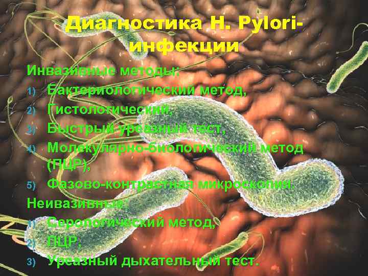 Диагностика H. Pyloriинфекции Инвазивные методы: 1) Бактериологический метод, 2) Гистологический, 3) Быстрый уреазный тест,