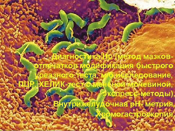 Диагностика Нр (метод мазковотпечатков модификация быстрого уреазного теста, м/б исследование, ПЦР, ХЕЛИК-тест с меченой