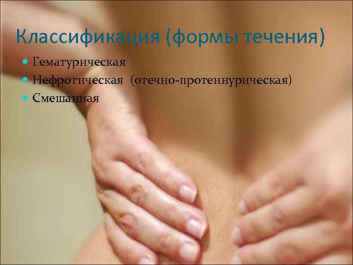 Классификация (формы течения) Гематурическая Нефротическая (отечно-протеинурическая) Смешанная 