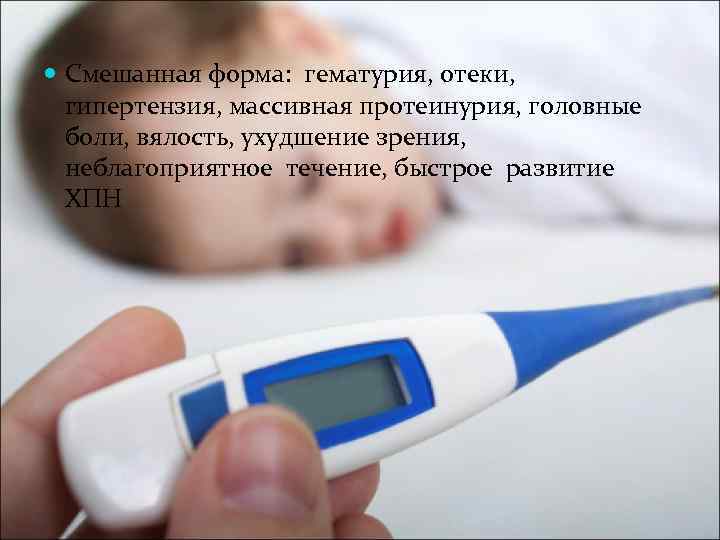  Смешанная форма: гематурия, отеки, гипертензия, массивная протеинурия, головные боли, вялость, ухудшение зрения, неблагоприятное
