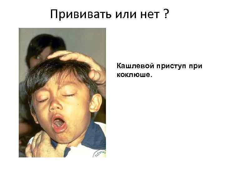 Прививать или нет ? Кашлевой приступ при коклюше. 