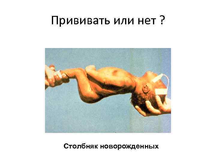 Прививать или нет ? Столбняк новорожденных 