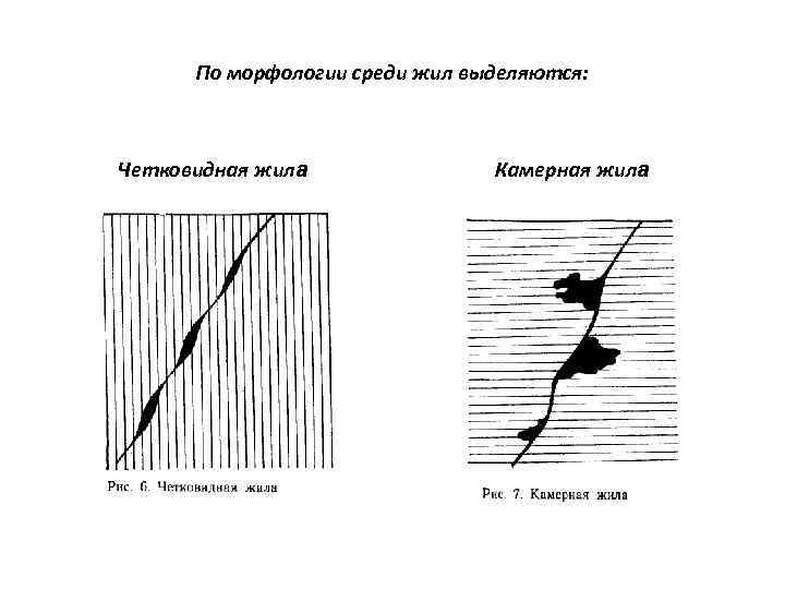 По морфологии среди жил выделяются: Четковидная жила Камерная жила 