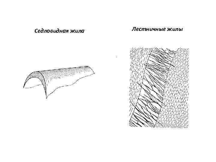 Седловидная жила Лестничные жилы 
