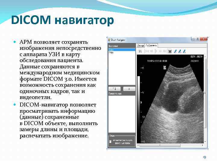 DICOM навигатор АРМ позволяет сохранять изображения непосредственно с аппарата УЗИ в карту обследования пациента.