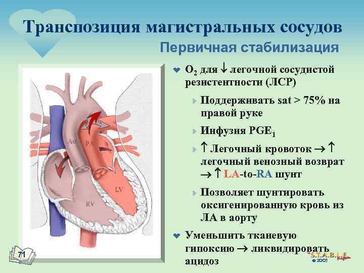 Магистральные сосуды. Транспозиция магистральных сосудов гемодинамика схема. Полная транспозиция магистральных сосудов гемодинамика. Транспозиция магистральных сосудов у новорожденных гемодинамика. Транспозиция магистральных сосудов педиатрия.