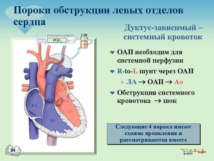 Пороки обструкции левых отделов сердца Дуктус-зависимый – PGE 1 системный кровоток PGE 1 ¤