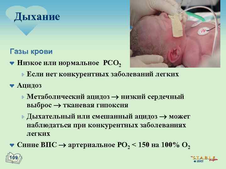 Дыхание Газы крови ¤ Низкое или нормальное PCO 2 ¥ Если нет конкурентных заболеваний