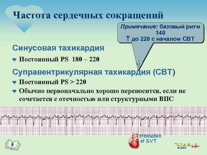 Частота сердечных сокращений Примечание: базовый ритм 140 до 220 с началом СВТ Синусовая тахикардия