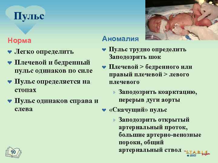 Пульс Аномалия Норма ¤ Пульс трудно определить ¤ Легко определить Заподозрить шок ¤ Плечевой