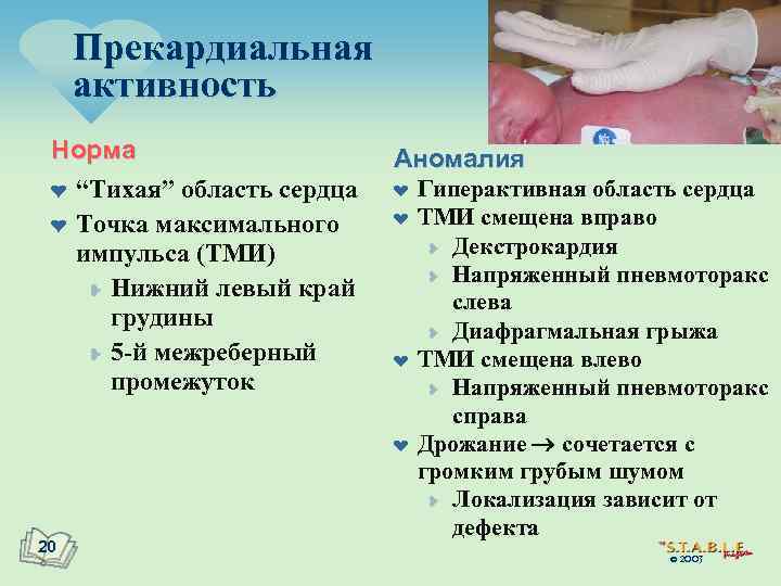 Прекардиальная активность Норма ¤ “Тихая” область сердца ¤ Точка максимального импульса (ТМИ) ¥ Нижний