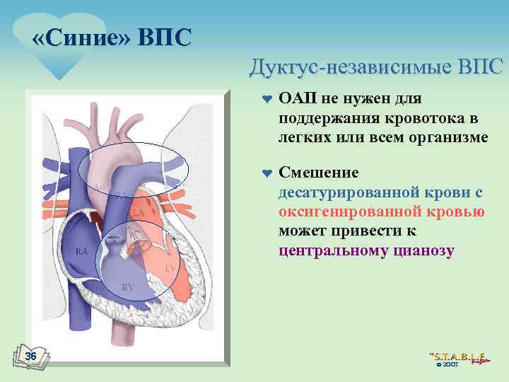  «Синие» ВПС Дуктус-независимые ВПС ¤ ¤ 36 ОАП не нужен для поддержания кровотока