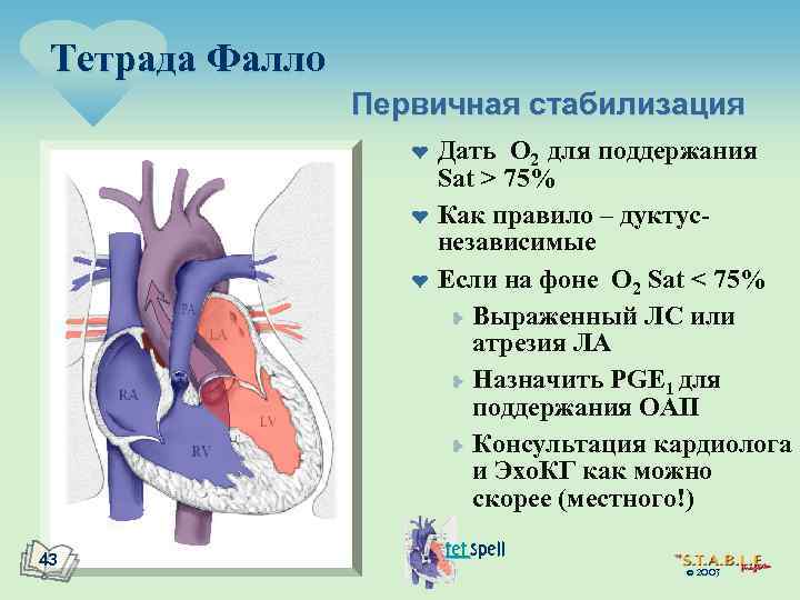 Тетрада Фалло Первичная стабилизация ¤ ¤ ¤ 43 Дать O 2 для поддержания Sat