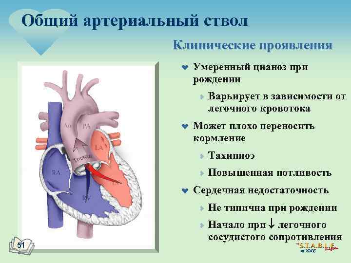 Общий артериальный ствол Клинические проявления ¤ Умеренный цианоз при рождении ¥ ¤ Варьирует в