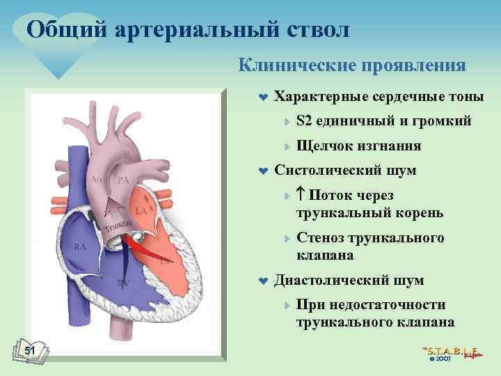 Общий артериальный ствол презентация