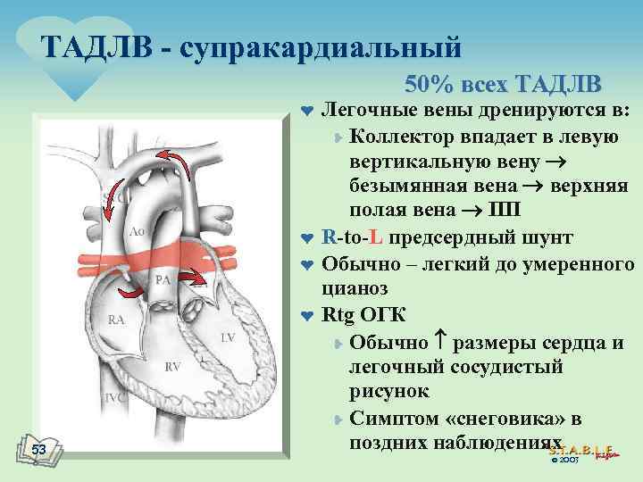 ТАДЛВ - супракардиальный 50% всех ТАДЛВ ¤ ¤ 53 Легочные вены дренируются в: ¥