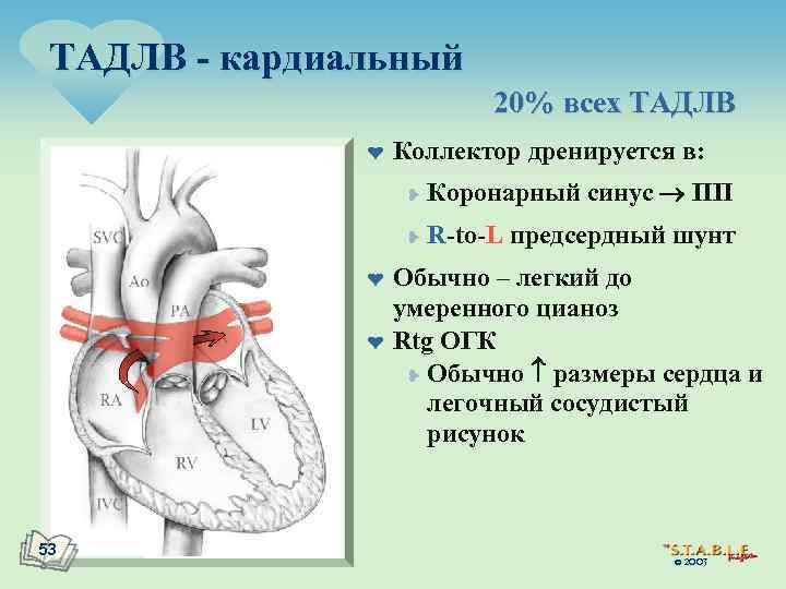 ТАДЛВ - кардиальный 20% всех ТАДЛВ ¤ Коллектор дренируется в: ¥ ¥ ¤ ¤