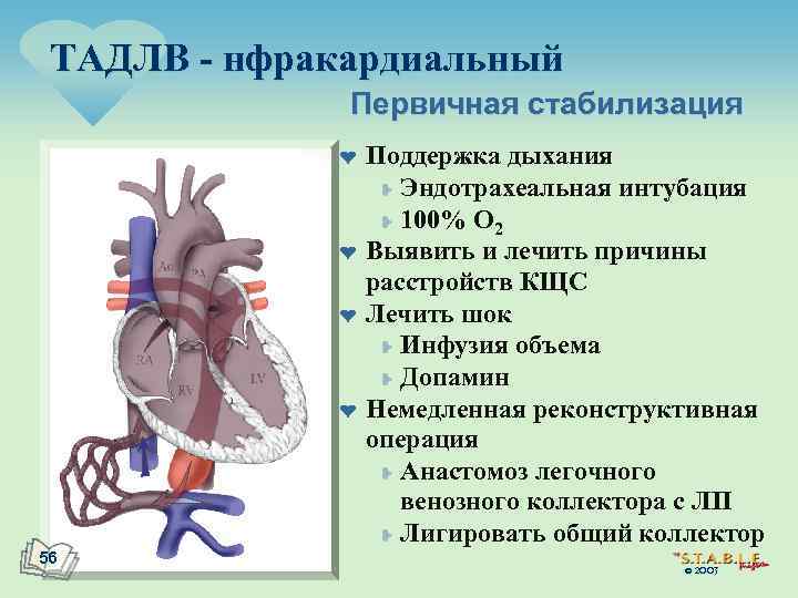 ТАДЛВ - нфракардиальный Первичная стабилизация ¤ ¤ 56 Поддержка дыхания ¥ Эндотрахеальная интубация ¥