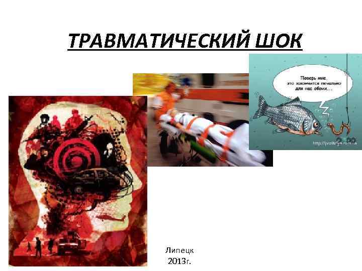 ТРАВМАТИЧЕСКИЙ ШОК Липецк 2013 г. 