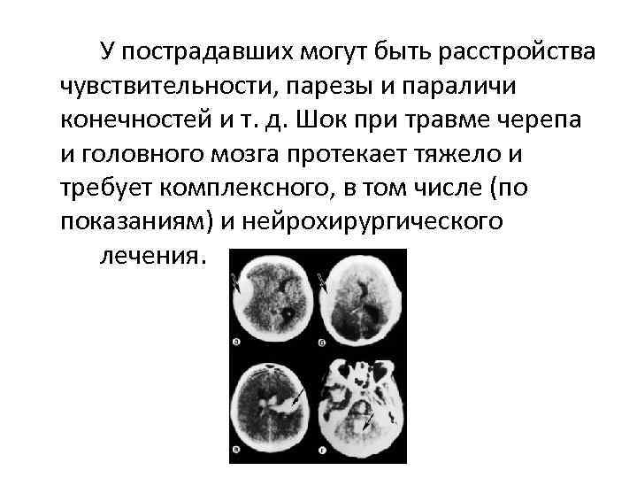 У пострадавших могут быть расстройства чувствительности, парезы и параличи конечностей и т. д. Шок