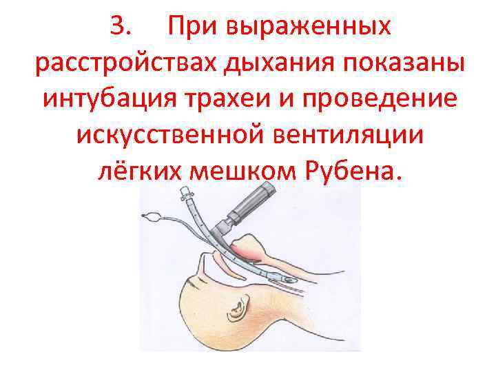 3. При выраженных расстройствах дыхания показаны интубация трахеи и проведение искусственной вентиляции лёгких мешком