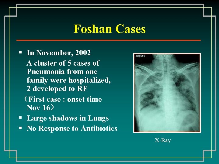 Foshan Cases § In November, 2002 A cluster of 5 cases of Pneumonia from