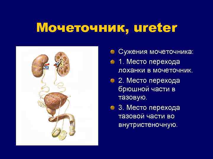 Мочеточник, ureter Сужения мочеточника: 1. Место перехода лоханки в мочеточник. 2. Место перехода брюшной