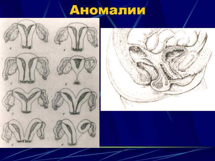 Аномалии 