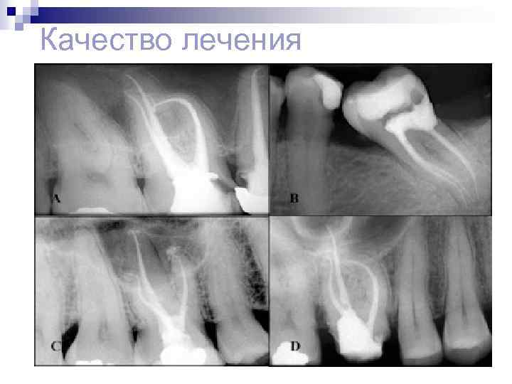 Качество лечения 