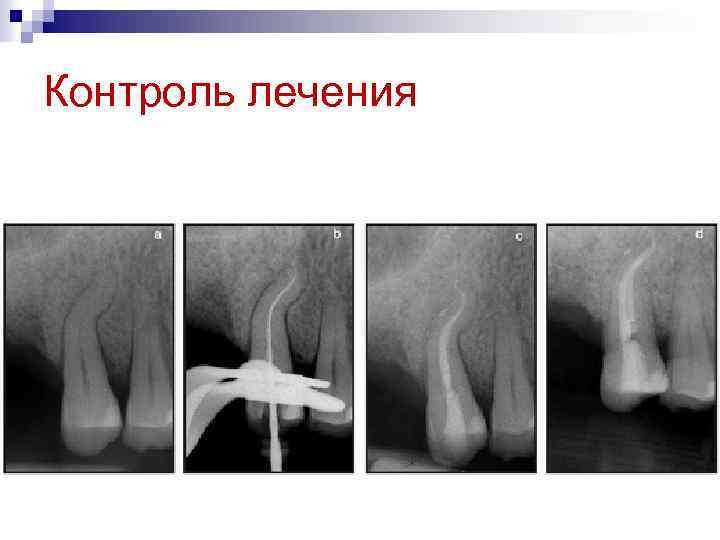 Контроль лечения 