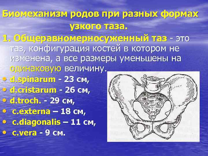 Расстояние между костями. Формы таза. Формы узкого таза. Общее строение таза.