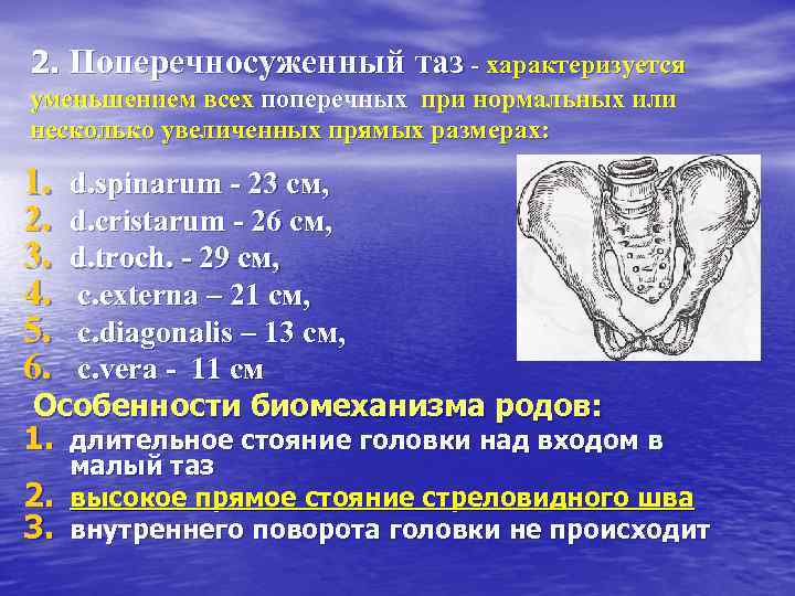 Гинекология малый таз. Степени сужения поперечносуженного таза. Поперечно суженный таз. Размеры поперечносуженного таза. Размеры поперечном чуженного таза.