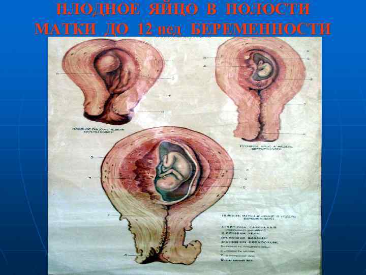 ПЛОДНОЕ ЯЙЦО В ПОЛОСТИ МАТКИ ДО 12 нед БЕРЕМЕННОСТИ 