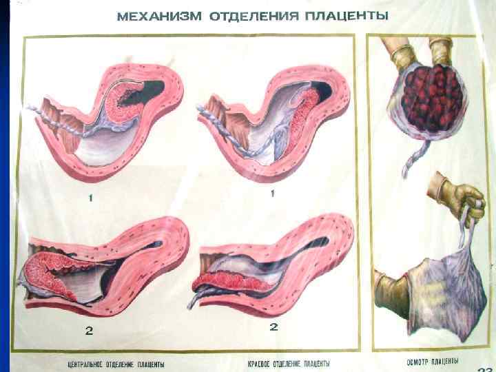 МЕХАНИЗМ ОТДЕЛЕНИЯ ПЛАЦЕНТЫ 