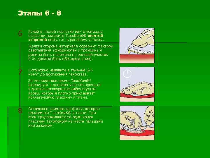 Этапы 6 - 8 6 Рукой в чистой перчатке или с помощью салфетки наложите