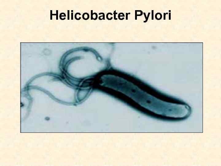 Helicobacter Pylori 