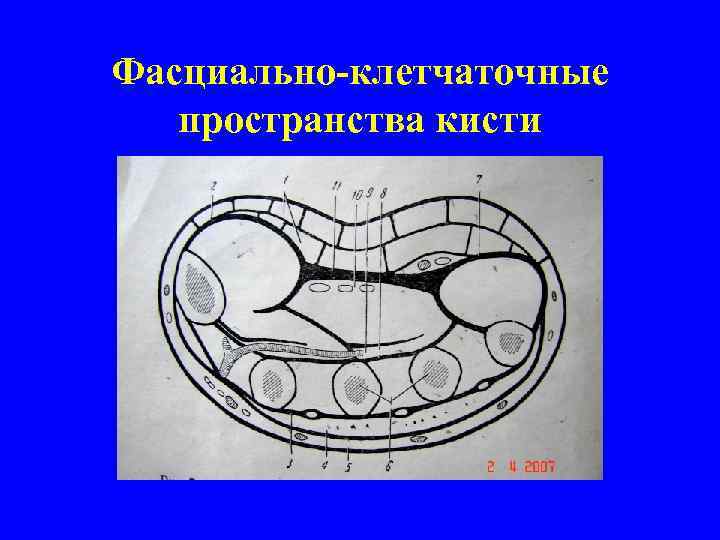 Поперечный распил кисти схема топографическая