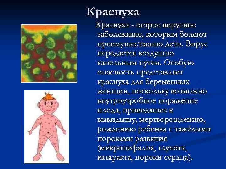 Краснуха - острое вирусное заболевание, которым болеют преимущественно дети. Вирус передается воздушно капельным путем.